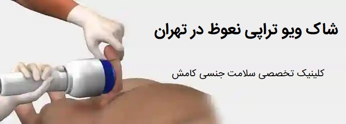 شاک ویو تراپی و درمان اختلال نعوظ در تهران