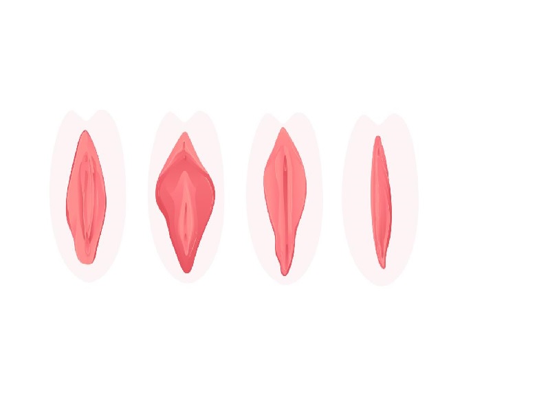 چه عواملی باعث تغییر شکل لبه های واژن می شود؟