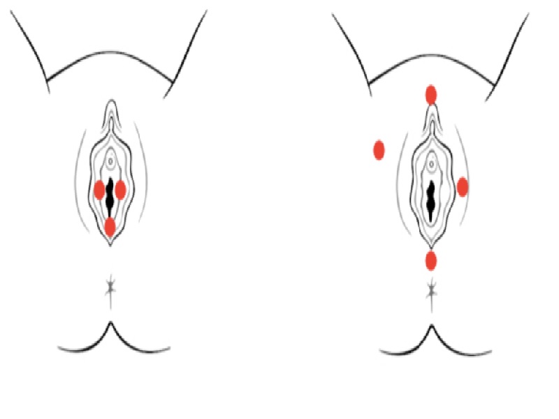 ولوودینیا چیست؟